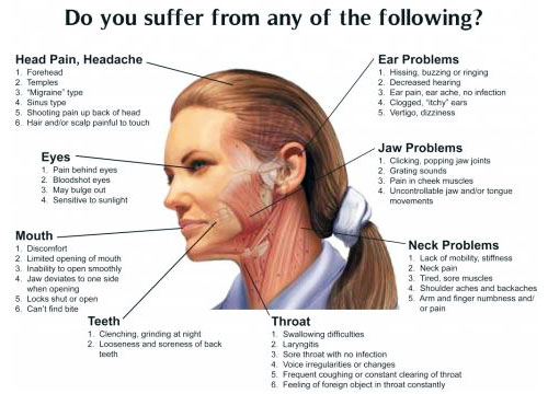 Migraines and TMJ Treatments | W. Kelly Harris DDS | Asheboro, NC